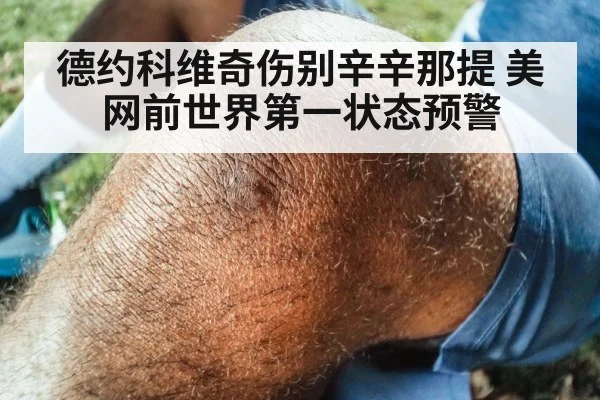 德约科维奇伤别辛辛那提 美网前世界第一状态预警